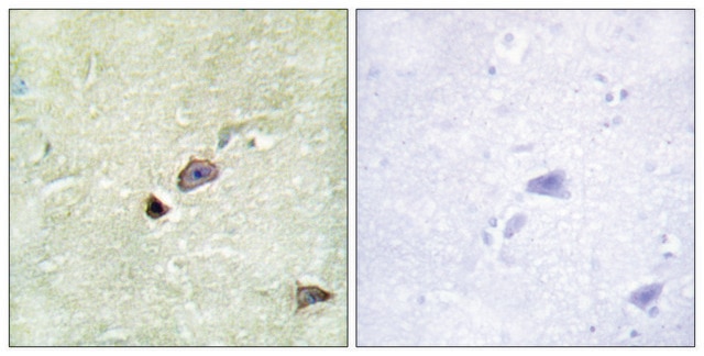 Anti-TRIM59 antibody produced in rabbit affinity isolated antibody