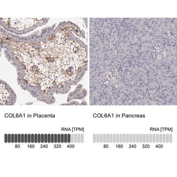 Anti-COL6A1 antibody produced in rabbit Prestige Antibodies&#174; Powered by Atlas Antibodies, affinity isolated antibody, buffered aqueous glycerol solution