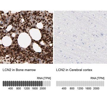 Anti-LCN2 antibody produced in rabbit Prestige Antibodies&#174; Powered by Atlas Antibodies, affinity isolated antibody, buffered aqueous glycerol solution