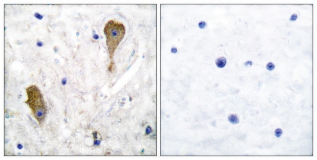 Anti-GAD1 antibody produced in rabbit affinity isolated antibody