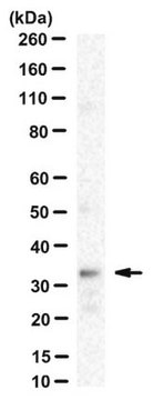 Anti-GnRH-R Antibody, clone F1G4 clone FIG4, from mouse