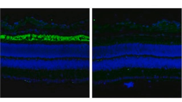 Anti-ABCA4 Antibody, clone TMR1 clone TMR1, from mouse