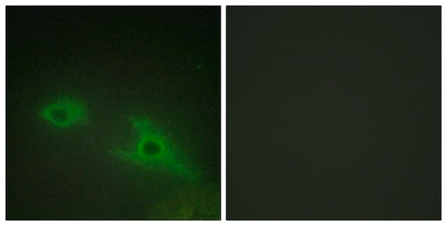 Anti-EPHA1 antibody produced in rabbit affinity isolated antibody