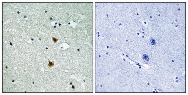 Anti-HSP27 antibody produced in rabbit affinity isolated antibody