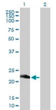 Anti-RETSAT antibody produced in mouse purified immunoglobulin, buffered aqueous solution