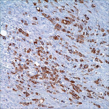 GCDFP-15 (23A3) + Mammaglobin Cocktail (304-1A5 &amp; 31A5) Mouse/Rabbit Monoclonal Antibodies