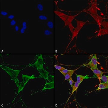 Monoclonal Anti-Lrrk2/Dardarin antibody produced in mouse clone S138-6, purified immunoglobulin