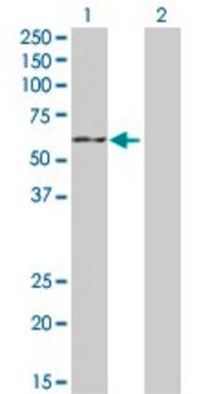 Anti-CYP19A1 antibody produced in rabbit purified immunoglobulin, buffered aqueous solution