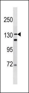 ANTI-DSPP (N-TERM) antibody produced in rabbit IgG fraction of antiserum, buffered aqueous solution