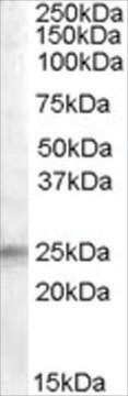 Anti-IGFBP6 antibody produced in goat affinity isolated antibody, buffered aqueous solution