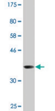 Monoclonal Anti-RBM10 antibody produced in mouse clone 2F12, purified immunoglobulin, buffered aqueous solution