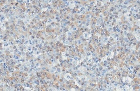 Anti-ALK Antibody, clone ALK1 clone ALK1, from mouse