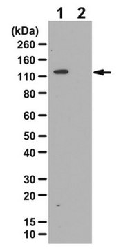 Anti-phospho-ULK1/ATG1 (Ser758) Antibody from rabbit, purified by affinity chromatography