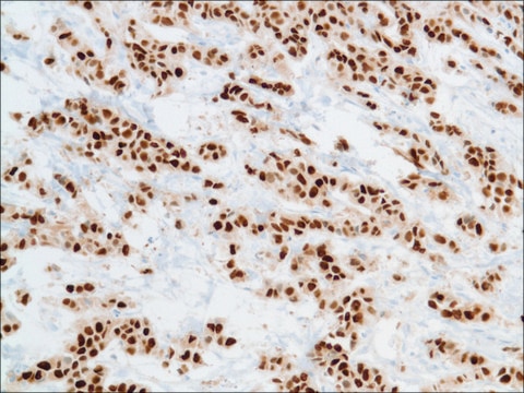 Anti-Progesterone Receptor antibody, Rabbit monoclonal recombinant, expressed in proprietary host, clone SP2, tissue culture supernatant