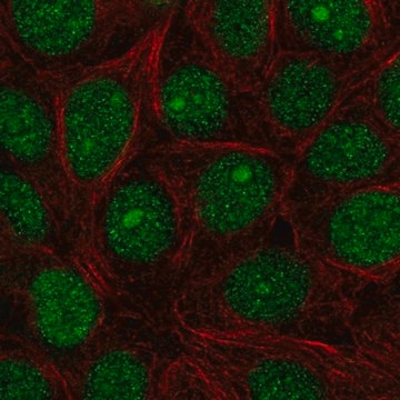 Anti-SPDEF antibody produced in rabbit Prestige Antibodies&#174; Powered by Atlas Antibodies, affinity isolated antibody