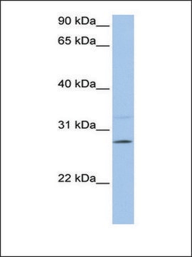 Anti-PEMT antibody produced in rabbit affinity isolated antibody