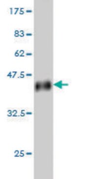 Monoclonal Anti-UPK1B antibody produced in mouse clone 1E1, purified immunoglobulin, buffered aqueous solution