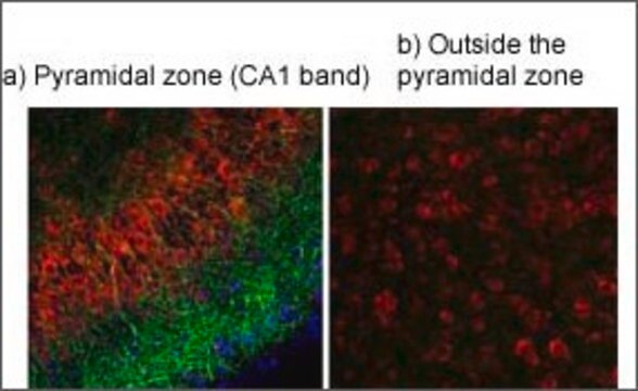 Anti-TRPV4 antibody produced in rabbit affinity isolated antibody