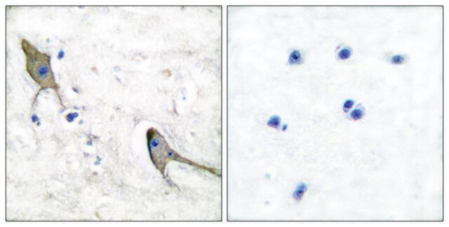 Anti-PYK2 antibody produced in rabbit affinity isolated antibody