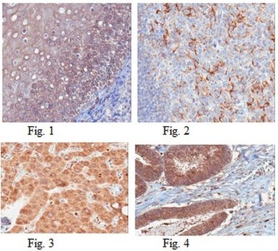 Anti-S1PR2/EDG5 Antibody, clone 6E8.1 clone 6E8.1, from mouse