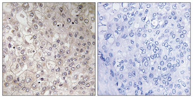 Anti-GIPR antibody produced in rabbit affinity isolated antibody