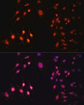 Anti-SETD2 antibody produced in rabbit