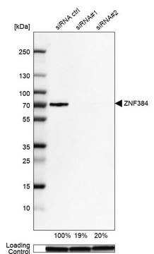 Anti-ZNF384 antibody produced in rabbit Prestige Antibodies&#174; Powered by Atlas Antibodies, affinity isolated antibody, buffered aqueous glycerol solution