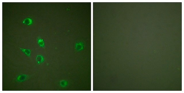 Anti-Glucagon antibody produced in rabbit affinity isolated antibody