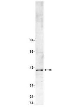 Anti-Casein Kinase 2 Antibody Upstate&#174;, from rabbit