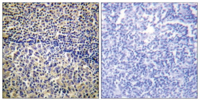 Anti-p47 PHOX antibody produced in rabbit affinity isolated antibody