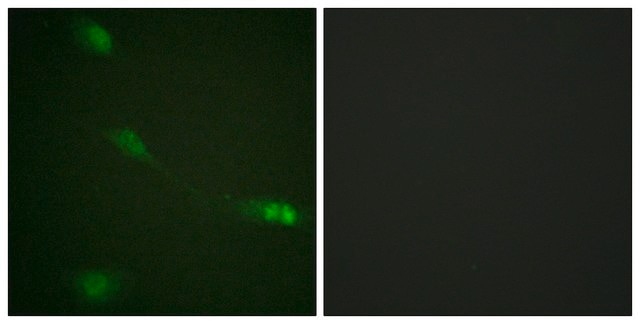 Anti-MDM2 antibody produced in rabbit affinity isolated antibody