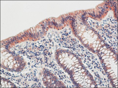 Anti-Claudin-4 (C-terminal) antibody produced in rabbit affinity isolated antibody