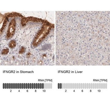 Anti-IFNGR2 antibody produced in rabbit affinity isolated antibody, buffered aqueous glycerol solution