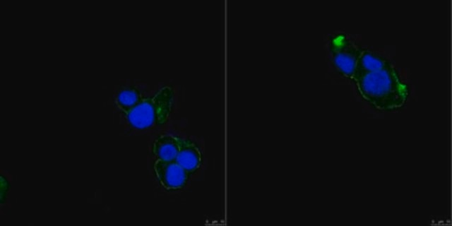 Anti-TRPV2 Antibody, clone 17A11 clone 17A11, from mouse