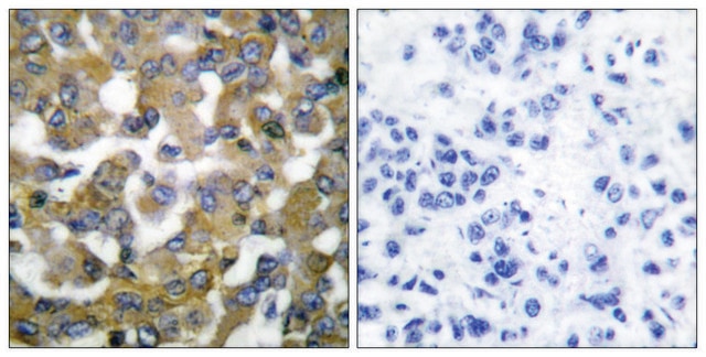 Anti-Keratin 19 antibody produced in rabbit affinity isolated antibody