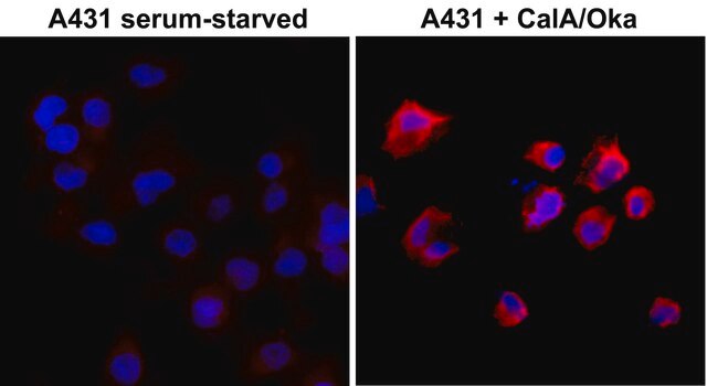 Anti-Phosphothreonine antibody, Rabbit monoclonal recombinant, expressed in HEK 293 cells, clone RM102, purified immunoglobulin