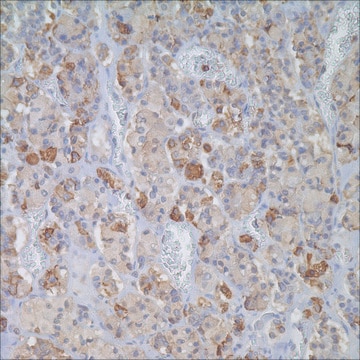 FSH Rabbit Polyclonal Antibody