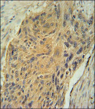 ANTI-AVP (CENTER) antibody produced in rabbit IgG fraction of antiserum, buffered aqueous solution