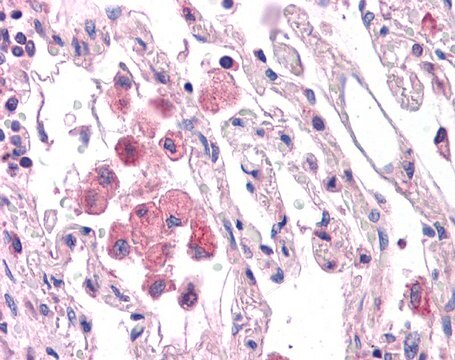 Anti-HNF1A antibody produced in rabbit affinity isolated antibody