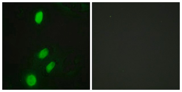 Anti-ETV6 antibody produced in rabbit affinity isolated antibody