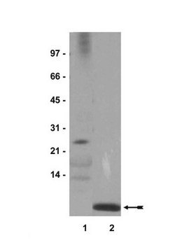 Anti-Ubiquitin Antibody Upstate&#174;, from rabbit