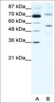 Anti-SIRT3 antibody produced in rabbit IgG fraction of antiserum