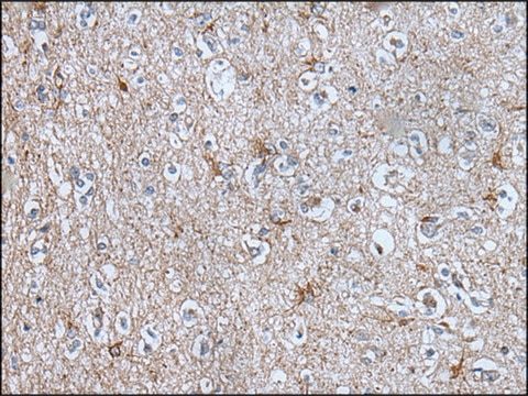 Anti-BMP1 affinity isolated antibody