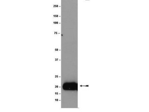 Anti-Ras Antibody, (K-, H-, N-), clone 9A11.2 clone 9A11.2, Upstate&#174;, from mouse