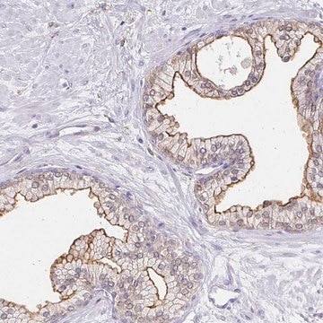 Anti-TAS1R3 antibody produced in rabbit Prestige Antibodies&#174; Powered by Atlas Antibodies, affinity isolated antibody, buffered aqueous glycerol solution