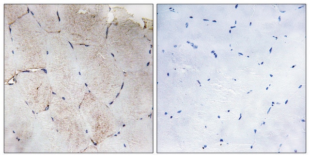 Anti-Collagen XII &#945;1 antibody produced in rabbit affinity isolated antibody