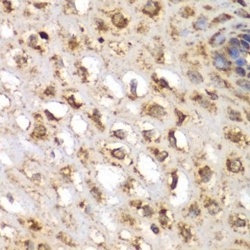 Anti-SGK1 antibody produced in rabbit