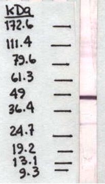 Anti-Pigment Epithelium Derived Factor Antibody, clone 10F12.2 clone 10F12.2, Chemicon&#174;, from mouse