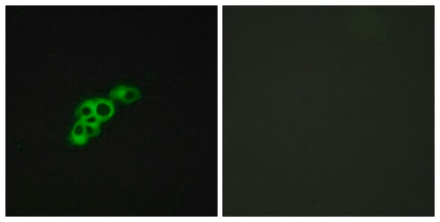 Anti-FSHR antibody produced in rabbit affinity isolated antibody