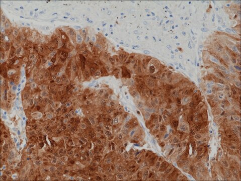 Anti-Arginase-1 (ARG1) antibody, Rabbit monoclonal recombinant, expressed in HEK 293 cells, clone RM377, purified immunoglobulin